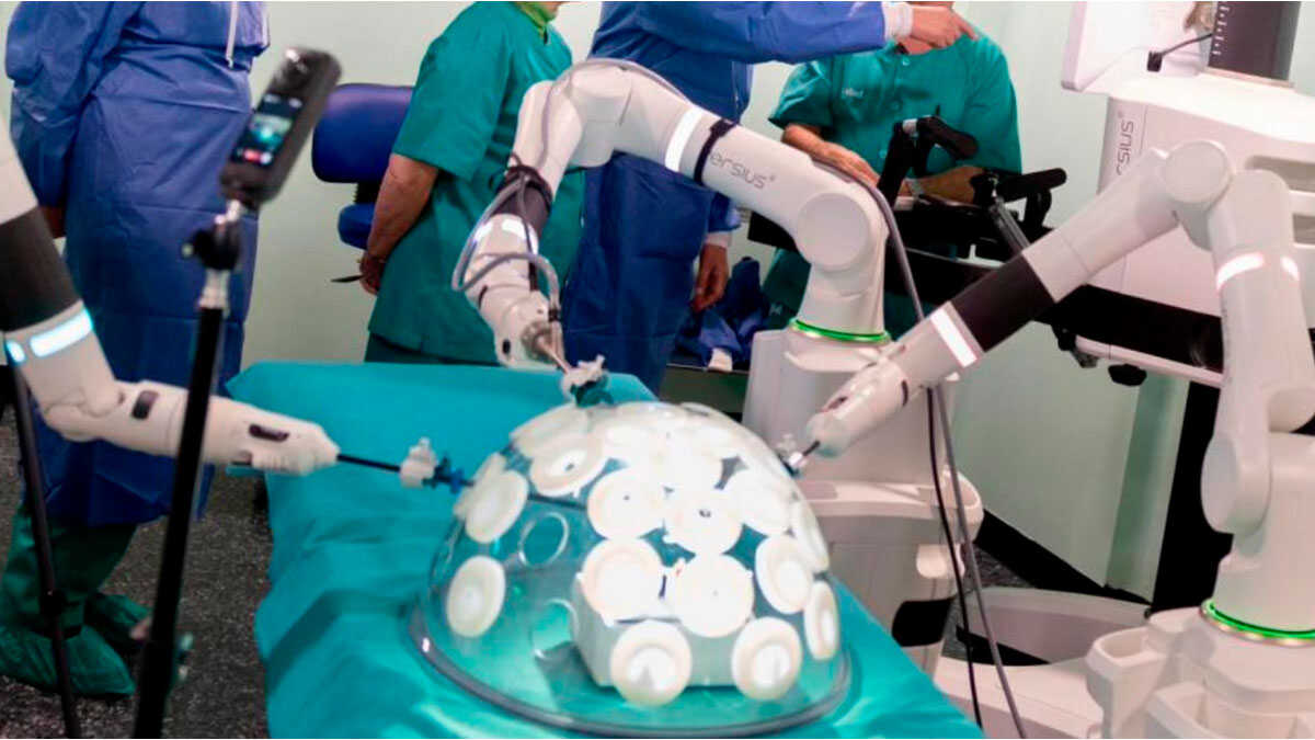Der OP-Roboter des Hospital Obispo Polanco in Teruel weckt Interesse in anderen spanischen Zentren